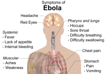 Ebola: Ten Shocking Things