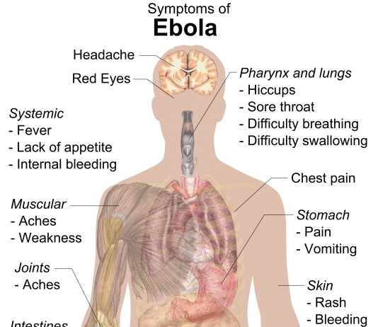 Ebola: Ten Shocking Things