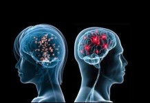 Poor sleep pattern could cause Brain Changes And Dementia