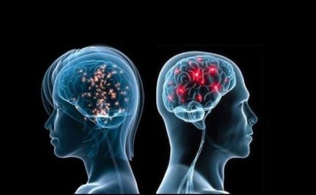 Poor sleep pattern could cause Brain Changes And Dementia