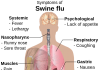 Swine Flu – Symptoms and Tips to follow