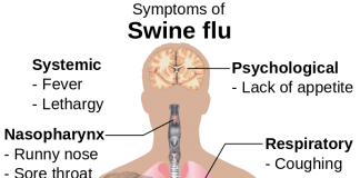 Swine Flu – Symptoms and Tips to follow