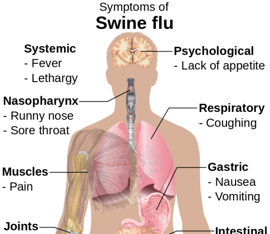 Swine Flu – Symptoms and Tips to follow
