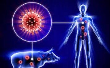 Swine Flu – Ayurvedic viewpoint and cure
