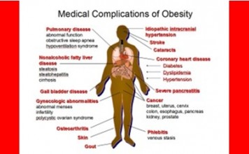 Why obesity in US keeps rising despite so-called healthy diets