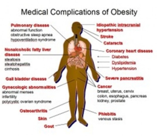 Why obesity in US keeps rising despite so-called healthy diets
