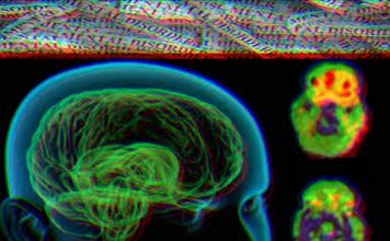 US Neurologist says chanting of Hare Krishna could heal Schizophrenia